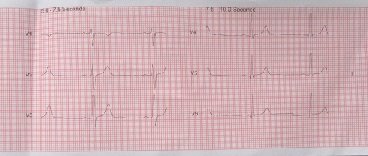 Heartbeat 001.JPG Heartbeat 001.JPG